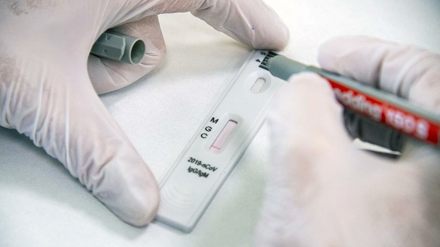 ЧУЗ «КБ «РЖД-Медицина» г.Астрахань проводит качественный анализ на выявление антител к короновирусной инфекции