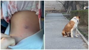 В Астрахани трехлетнюю девочку укусила собака