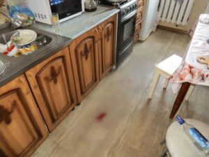 Местный Тайсон: под Астраханью мужчина откусил часть уха своему другу