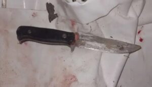 В Астрахани разъяренная женщина пролила кровь экс-мужа, но потом пожалела его