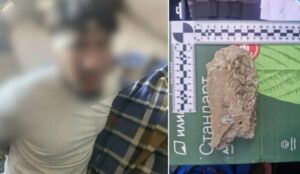 В Астрахани мужчина отстоял честь девушки, к нему пришли и пробили голову камнем